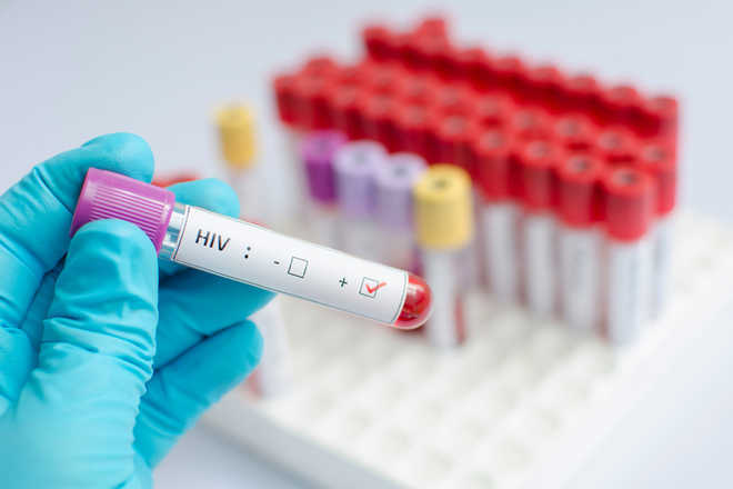 New paper-based test to detect HIV early