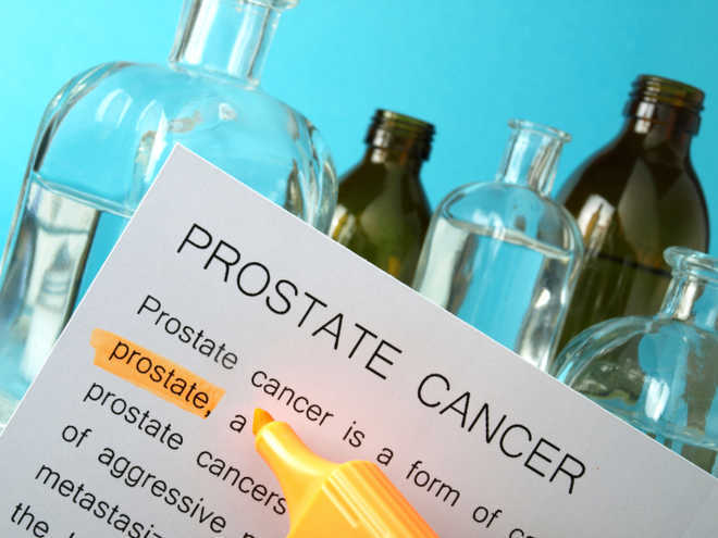 Prostate cancer: Symptoms and treatment