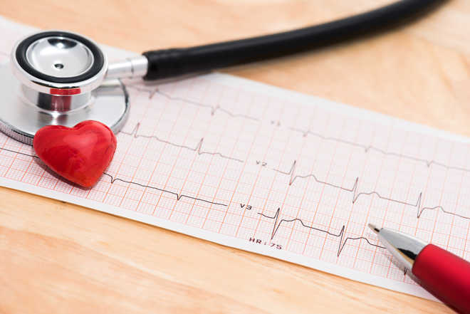 Scientists identify 36 new genes implicated in cardiac disease