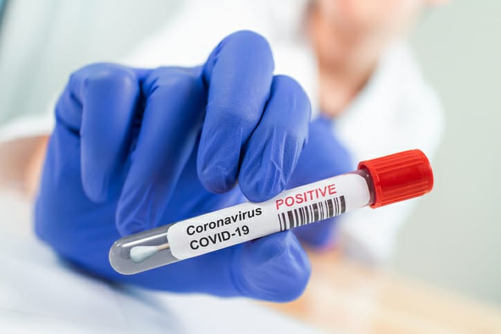 Confirmed coronavirus cases reach 20 million