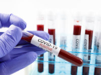 Close up of microbiologist hand with surgical gloves holding a positive blood test result for coronavirus. Test tubes rack with blood sample for covid-19 virus, on white background with copy space.