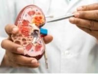 Don’t ignore the signs! Get these 5 tests to identify kidney diseases