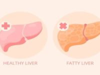 Fatty Liver Cases Rise in India: 7 Ways to Keep Your Liver Safe and Healthy