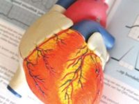 Faster cognitive decline linked with heart attacks