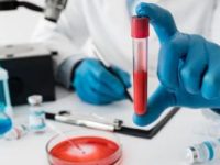 Simple blood test may predict heart and kidney disease risk in type-2 diabetes patients: Study