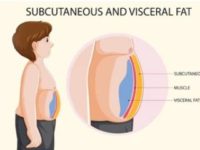 Visceral fat: Here Are Some Remedies To Reduce It