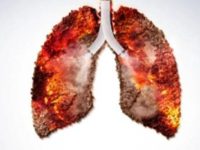 Family history may raise risk of some lung cancers: Study